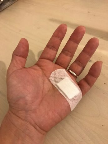 ゴルフを始めたら左手小指がバネ指になったので手術をしてみた体験談。